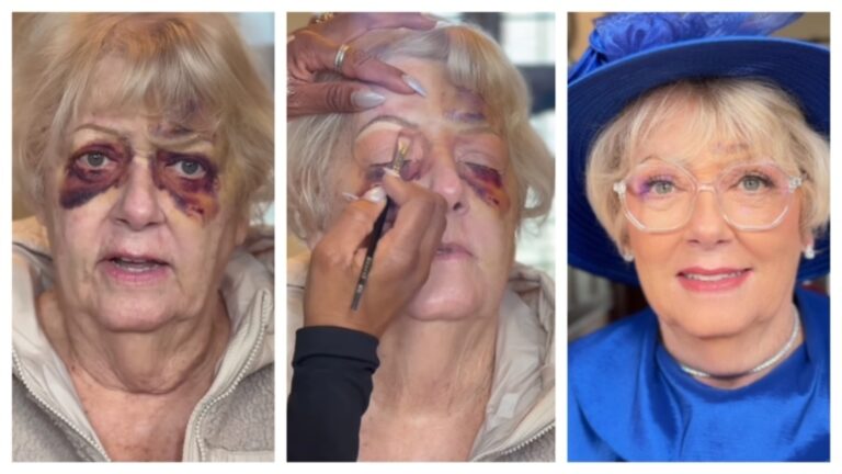 Makeup artist helps bride’s mother regain confidence by covering her eye bruises, winning hearts online: Watch | Fashion Trends