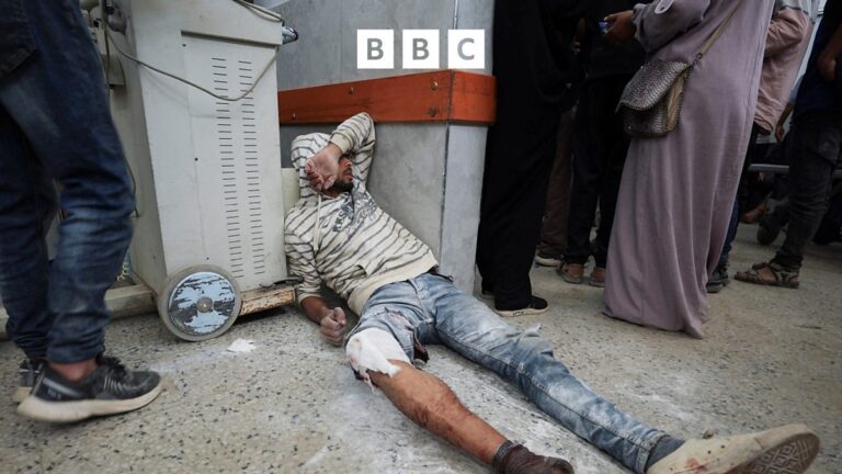 Patterns of injury in a Gaza war hospital