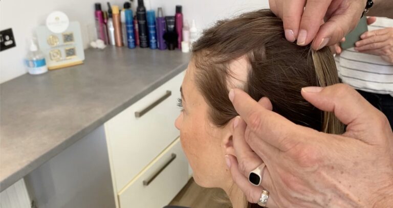 Alopecia Awareness Month 2025 – facing the challenges of living with hair loss