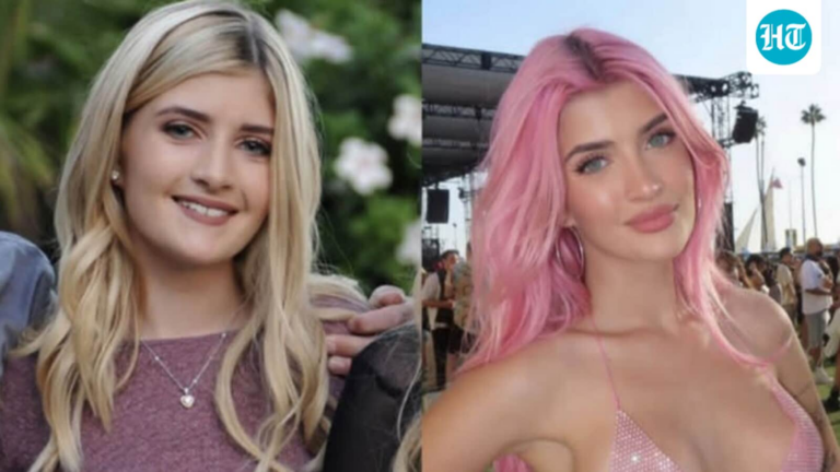 Denise Richards's 21 year old daughter Sami shares shocking transformation photos, reveals ‘all her plastic surgeries’
